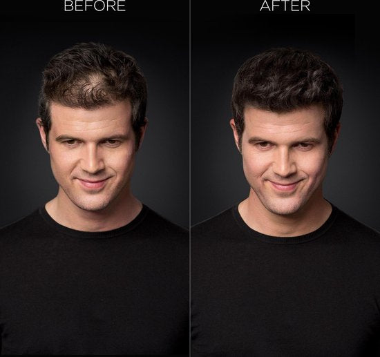 Toppik Colored Hair Thickener Zwart- Haarverdikker Spray - Verbergt haaruitval - Direct voller haar