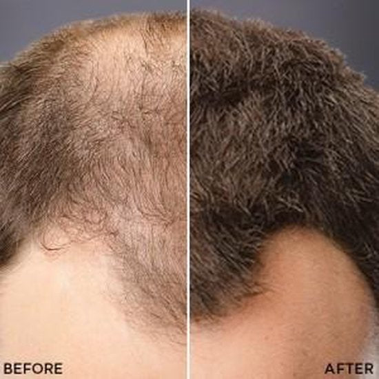 Toppik Colored Hair Thickener Lichtbruin - Haarverdikker Spray - Verbergt haaruitval - Direct voller haar