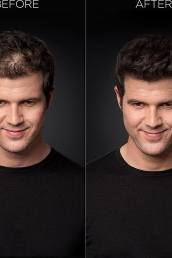 Toppik Colored Hair Thickener Zwart- Haarverdikker Spray - Verbergt haaruitval - Direct voller haar