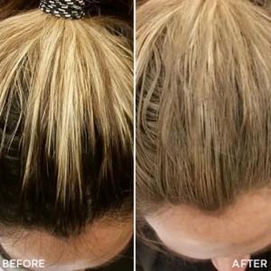 Toppik Colored Hair Thickener Zwart- Haarverdikker Spray - Verbergt haaruitval - Direct voller haar