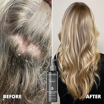 L’ANZA Scalp Therapy Scalp Massage Brush